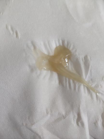 月经前白带