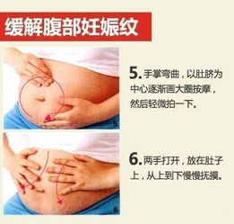 怎么样预防妊娠纹才好?