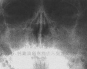 瓦氏位名词解释