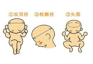 双顶径，双顶径是什么