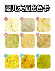 新生儿宝宝的大便什么颜色的正常 - 百度宝宝知道