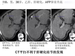 网络语ct是什么意思?