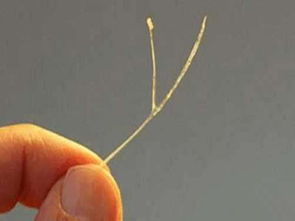 鱼刺卡喉应该怎么办?这些小妙招不可偏信