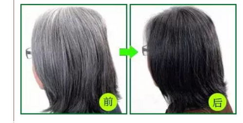 吃什么可以黑发