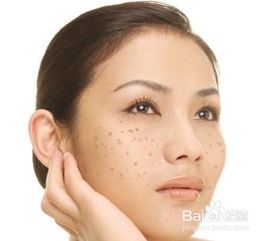 用桑叶洗脸可以去祛斑吗?如果可以那要怎么洗?