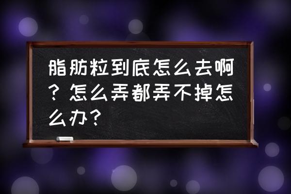 快速去痘的偏方分享给你 脂肪粒到底怎么去啊?怎么弄都弄不掉怎么办? 快速去痘的偏方分享给你 脂肪粒到底怎么去啊?怎么弄都弄不掉怎么办?