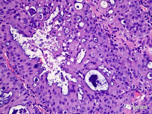 嗜酸性细胞是怎样产生的?