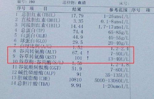 转氨酶正常值范围