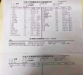转氨酶多少是正常