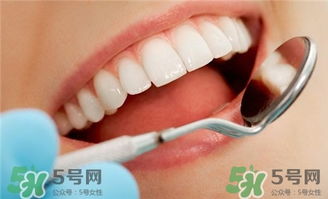 美白牙贴真的有用吗 美白牙贴对牙齿伤害大吗