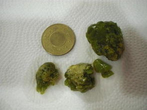 结石吃什么好，结石吃什么好得快