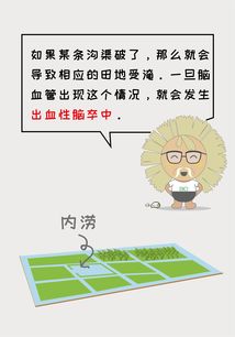 什么是脑卒中