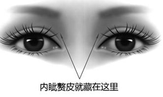 内眦怎么读