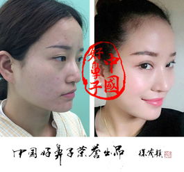 牛为什么要穿鼻子