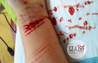 在手腕上割一刀自杀没成功后拍照片在空间晒自杀的人是什么心态啊?_百