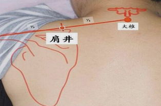 肩井的正确找法
