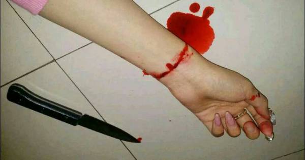 自残的照片手腕的女，自残的照片真实