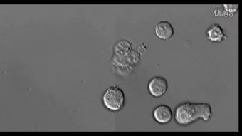 capture是什么意思