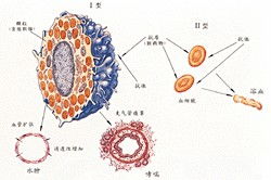 变态反应是什么意思
