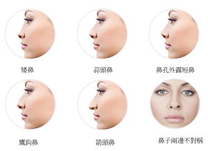 鼻根在哪?,