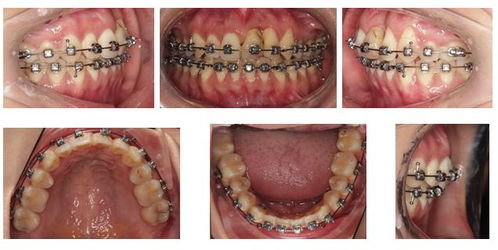 口内的解释口内的解释是什么