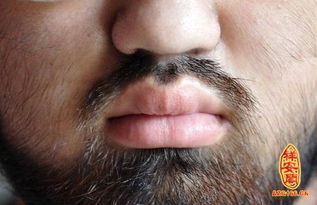 汗毛怎么永久去除，汗毛多的女生怎么去除