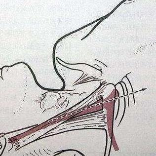 置什么意思?近义词和反义词是什么?英文翻译是什么?