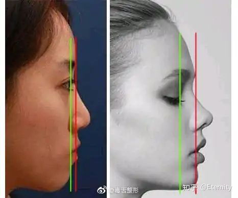 山根是什么意思?