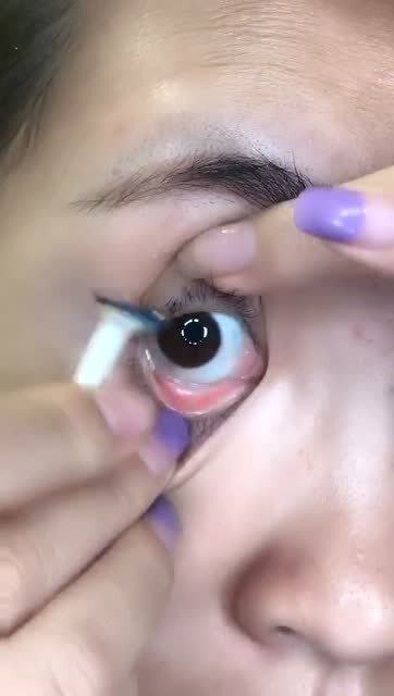 眼珠子疼是怎么回事，眼珠子一只眼睛正一只眼睛歪