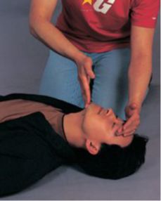 全麻术后舌后坠的处理方法，昏迷患者舌后坠的处理方法