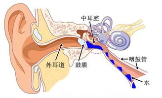 咽鼓管异常开放怎么办?