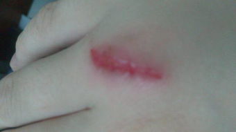 痂怎么读 痂的读音