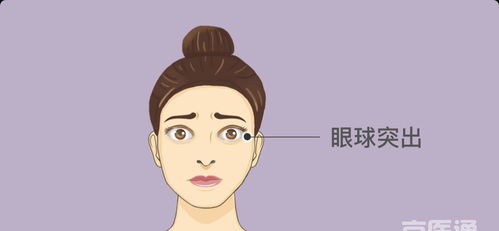 炯炯有神是什么意思?