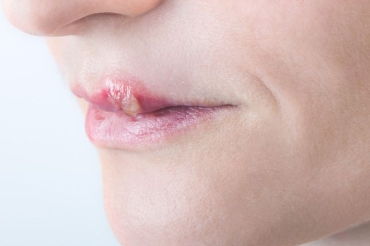 唇亡齿寒，唇寒齿亡在线观看