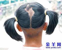 拔头发会损伤毛囊吗，拔头发拔出来的白色的东西是什么