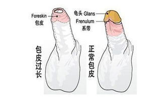 什么是包皮