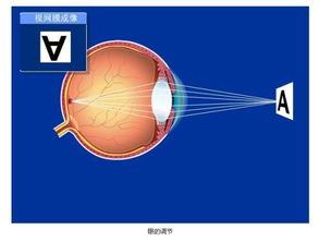 正常人的眼睛“明视距离”是___cm,小红想通过镜子仔细观察自己脸上皮 