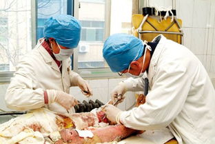 轻度烧伤怎么治好的比较快，轻度烧伤的范围