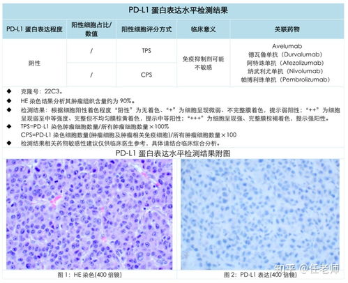 肿瘤TMB是什么意思，tmb-h