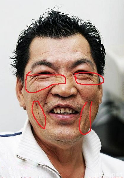 什么是脸上的横肉?