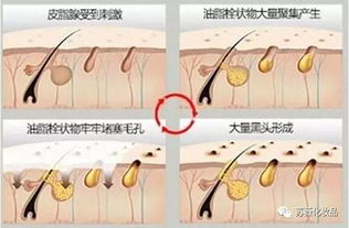 女生换黑头什么意思，陈不凡黑头什么意思