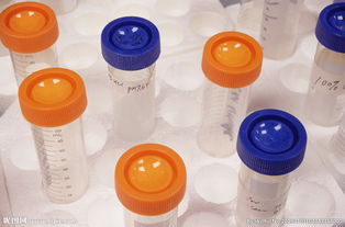 化学用品在哪里购买，化学用品进入眼睛应该立即