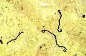 犬钩端螺旋体病症状