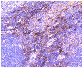 以撒的结合胎衣+新道具tonsil怎么获得