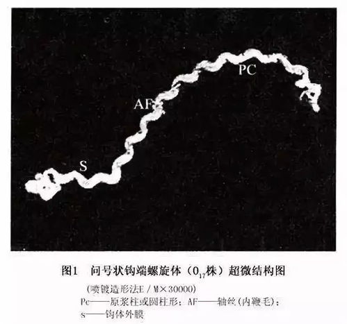 钩端螺旋体是什么菌，钩端螺旋体显微镜图片