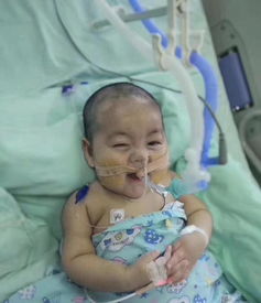 picu是什么科室，picu一天的费用是多少