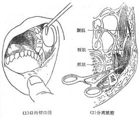 颊怎么读