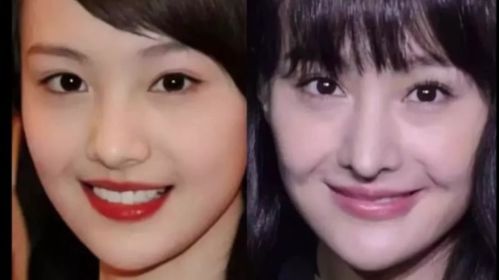 龅牙东，龅牙兔八哥