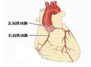 什么是心音?