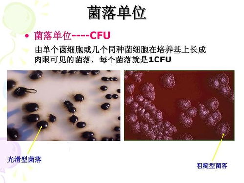 cfu是什么单位怎么读，cfu/ml是什么单位